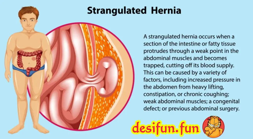 What is a hernia? Is there any solution for it?